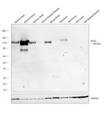 ACE2 Antibody in Western Blot (WB)