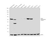 DOPA Decarboxylase Antibody in Western Blot (WB)