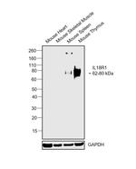 IL18R1 Antibody in Western Blot (WB)