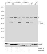 OAS2 Antibody in Western Blot (WB)