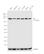 Alix Antibody in Western Blot (WB)