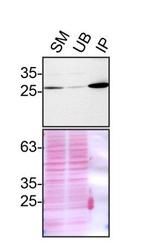 VAPB Antibody in Immunoprecipitation (IP)