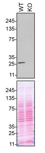 VAPB Antibody in Western Blot (WB)