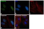 SMARCB1 Antibody in Immunocytochemistry (ICC/IF)