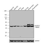 UQCRC2 Antibody in Western Blot (WB)