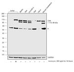 Cbl-b Antibody in Western Blot (WB)