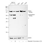 RAD21 Antibody in Western Blot (WB)