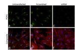 PCM1 Antibody in Immunocytochemistry (ICC/IF)