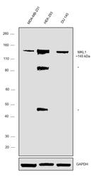 MKL1 Antibody in Western Blot (WB)