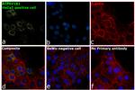 ATP6V1B1 Antibody