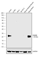 RAB9B Antibody