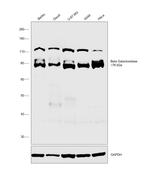 GLB1 Antibody in Western Blot (WB)