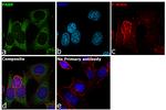 PABP Antibody in Immunocytochemistry (ICC/IF)