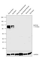 SAP102 Antibody in Western Blot (WB)