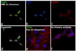 BCL11A Antibody