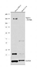 Nephrin Antibody in Western Blot (WB)