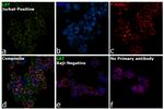 LAT Antibody in Immunocytochemistry (ICC/IF)