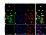 XRCC3 Antibody in Immunocytochemistry (ICC/IF)