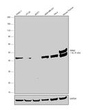 RRM2 Antibody in Western Blot (WB)