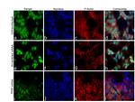 PHIP Antibody in Immunocytochemistry (ICC/IF)