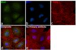 RhoC Antibody in Immunocytochemistry (ICC/IF)