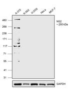 NG2 Antibody in Western Blot (WB)