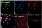 EGR1 Antibody in Immunocytochemistry (ICC/IF)