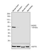 GAD65 Antibody