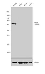 Glypican 3 Antibody