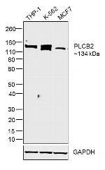 PLCB2 Antibody in Western Blot (WB)