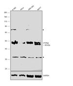 PTPN2 Antibody in Western Blot (WB)