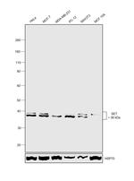 SET Antibody in Western Blot (WB)