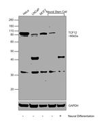 TCF12 Antibody in Western Blot (WB)