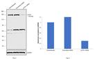 LATS1 Antibody in Western Blot (WB)