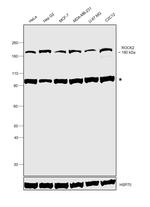 ROCK2 Antibody in Western Blot (WB)