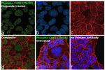 Phospho-CHK2 (Thr68) Antibody in Immunocytochemistry (ICC/IF)