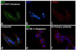 NSE Antibody in Immunocytochemistry (ICC/IF)