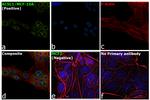 ACSL1 Antibody in Immunocytochemistry (ICC/IF)