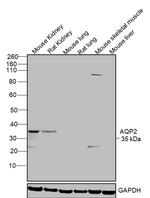 Aquaporin 2 Antibody in Western Blot (WB)