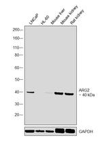 Arginase 2 Antibody in Western Blot (WB)