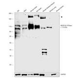 SERCA2 ATPase Antibody in Western Blot (WB)