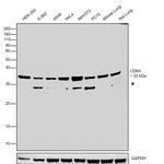 CDK4 Antibody in Western Blot (WB)