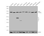 ChAT Antibody in Western Blot (WB)