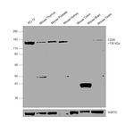 CD26 Antibody in Western Blot (WB)