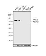 Desmoglein 3 Antibody in Western Blot (WB)