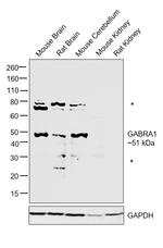 GABRA1 Antibody in Western Blot (WB)