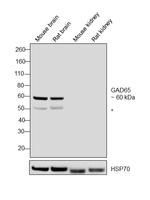 GAD65 Antibody