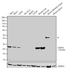 GSTM1 Antibody