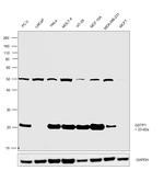 GSTP1 Antibody in Western Blot (WB)