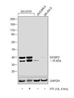 IGFBP2 Antibody in Western Blot (WB)